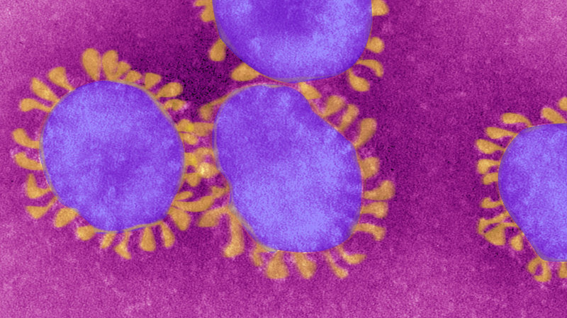 Coronavirus - COVID-19.  Colorized image of the actual virus under a microscope.